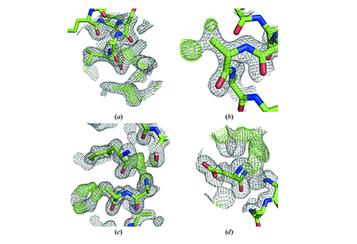 Automated de novo phasing and model building of coiled-coil proteins